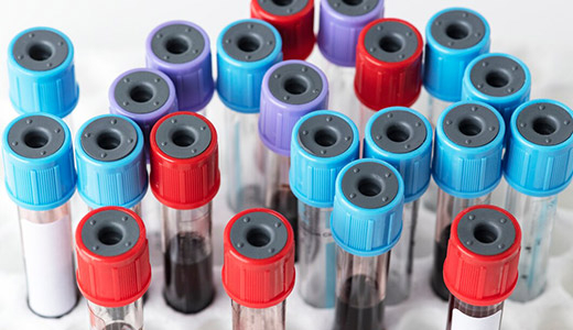 Hematology Reagent